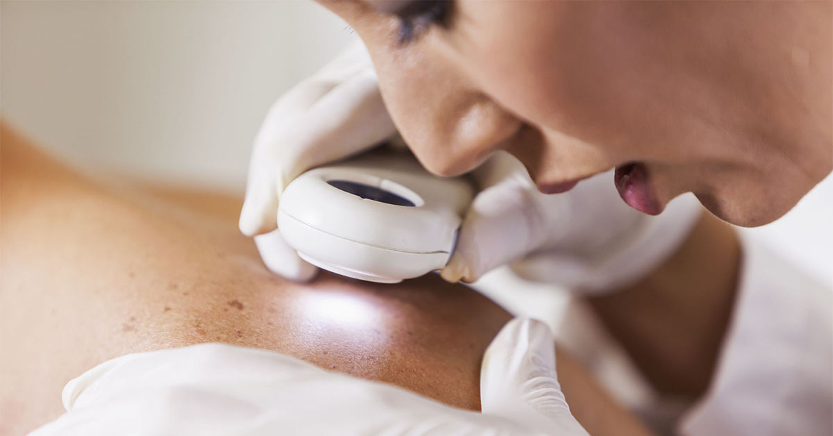 4 Important Questions to ask your Patients to Prescribe a Suitable Regimen