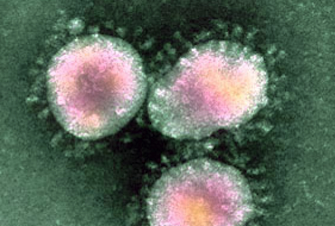 Fauci Gives Updates on the Progress of a Vaccine Development Against the Coronavirus