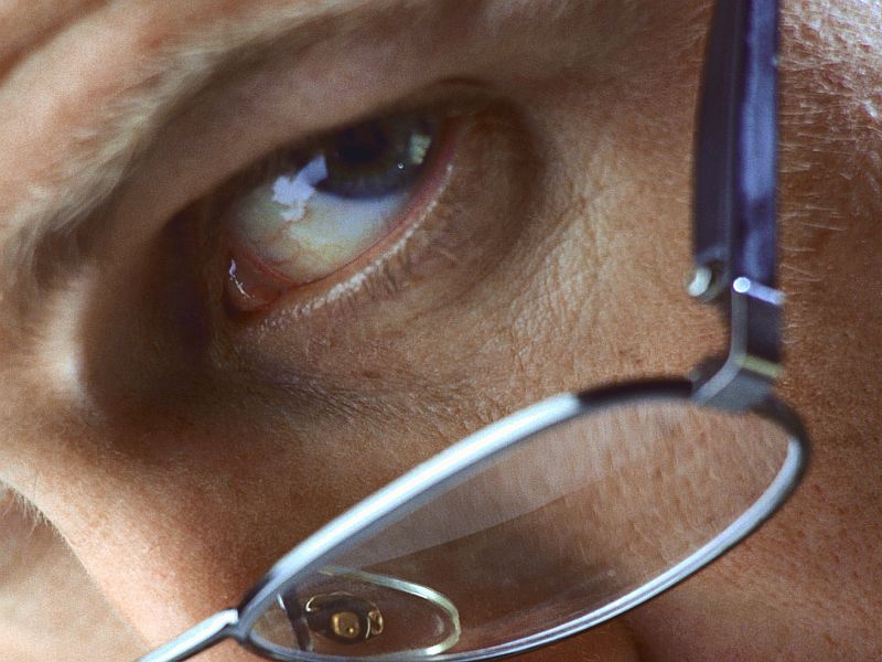 AAO: Stem Cell Retinal Pigment Epithelial Cells Safe in Dry AMD