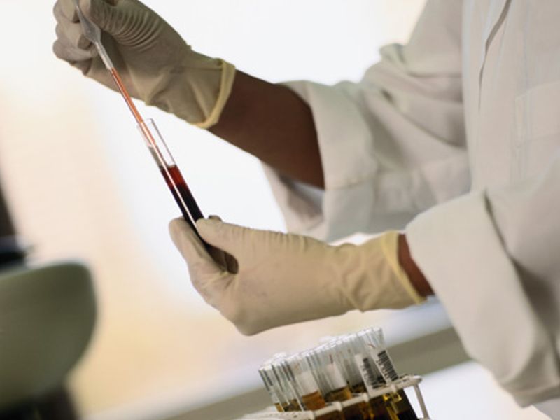 Tau May Predict Neurological Outcome After Cardiac Arrest