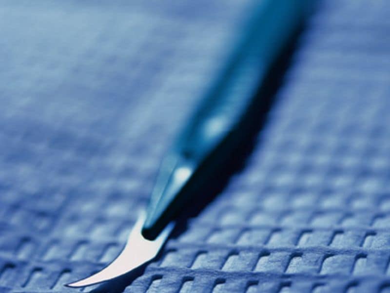 Bariatric Surgery Lowers Microvascular Disease Risk