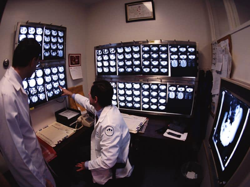 NIH Releases Large-Scale Dataset of CT Images