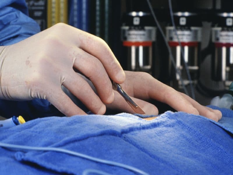 One-Third of Canadian Patients Get Hip Fx Repair Within 24 Hours