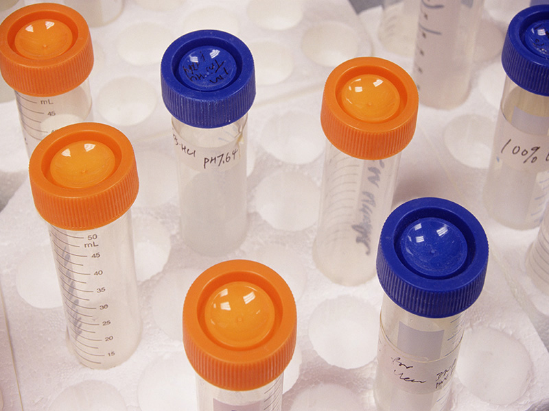 Intestinal Glucose Stimulation Has Anti-Incretin Effect