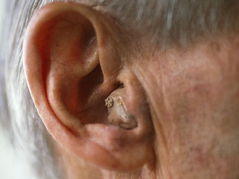 Cardiovascular Comorbidity Tied to Hearing Loss in Older Old
