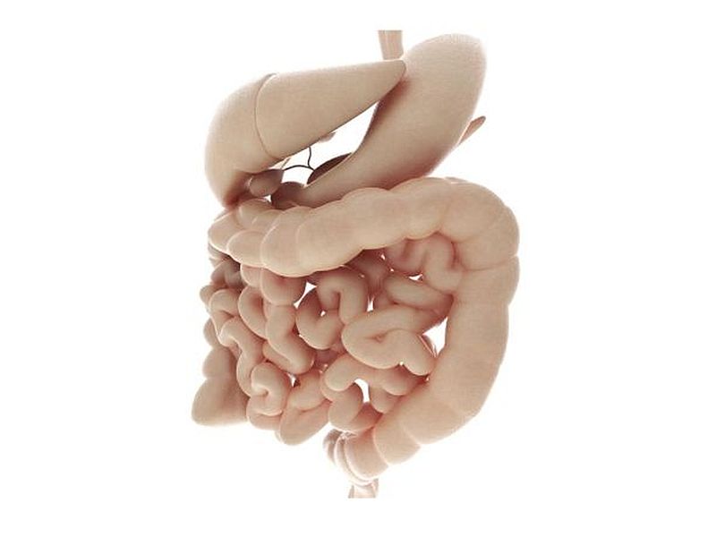 Predictors of Infliximab Response in Ulcerative Colitis Identified