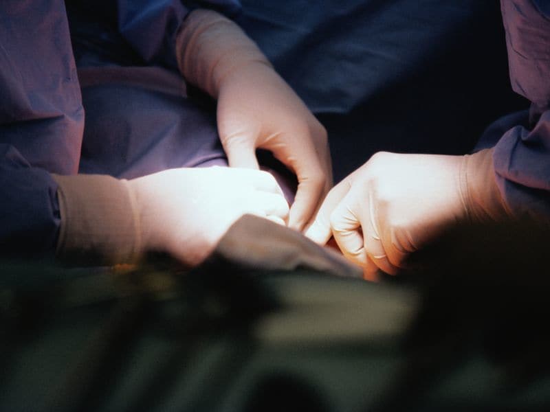 Surgical Mesh Itself Not Tied to Increased Complications