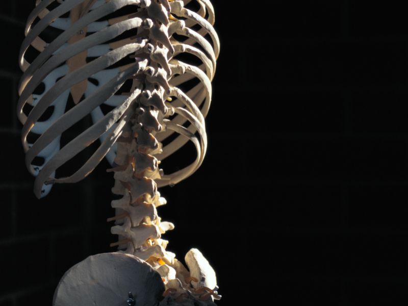 Possible Link Found Between Poor Diet and Back Injuries