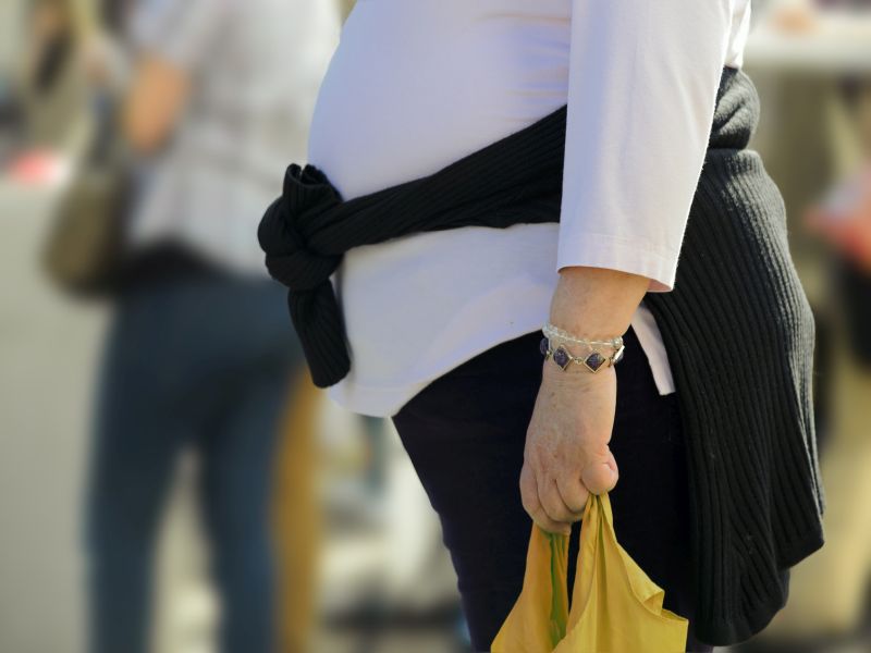 Adult Obesity Prevalence Varies With Level of Urbanization