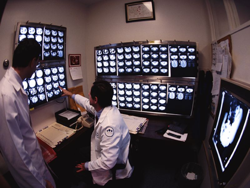 MRI Diagnostic for Differentiating Low-Grade Bladder Cancers