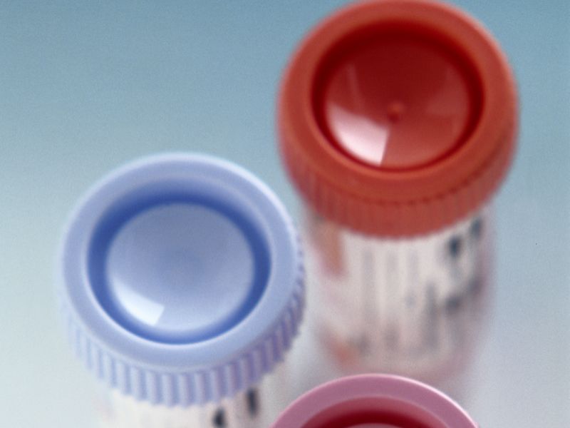 More Than Two-Thirds of Post-Op Patients Have Unused Opioids