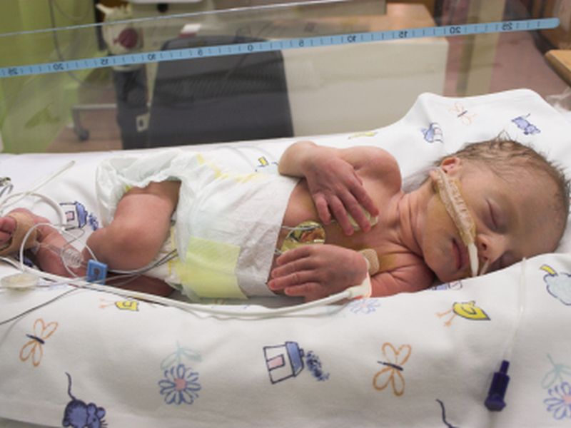 Inhaled Nitric Oxide Doesn't Cut Mortality for Neonates