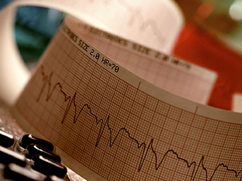 Survival Down With Ventricular Arrhythmia Early Post CF-LVAD