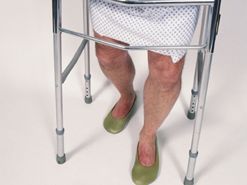 Increased Risk of MI, Stroke for Patients With Hip Fracture
