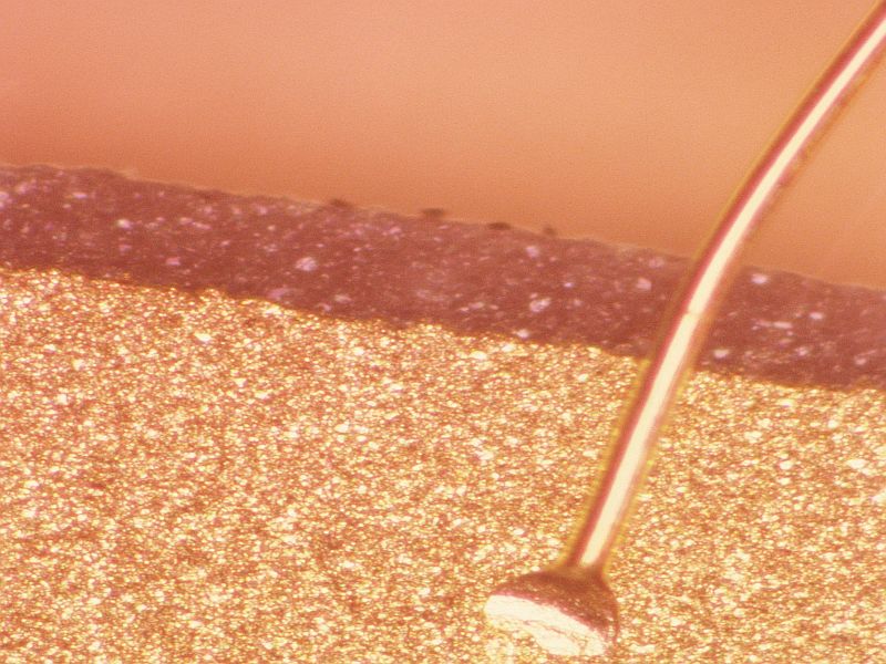 Early, Single Non-Ablative Fractional Laser Tx Aids Scarring