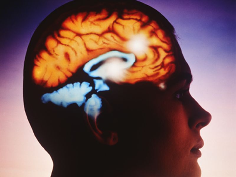 Deep Brain Stimulation Tied to Improved Symptoms in Tourette