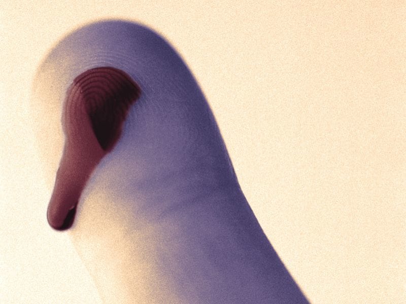 Emicizumab Prophylaxis Cuts Bleeding in Hemophilia A