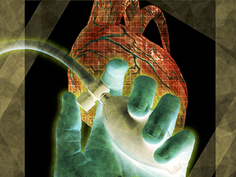Center Surgical Volume Linked to LVAD Patient Outcomes