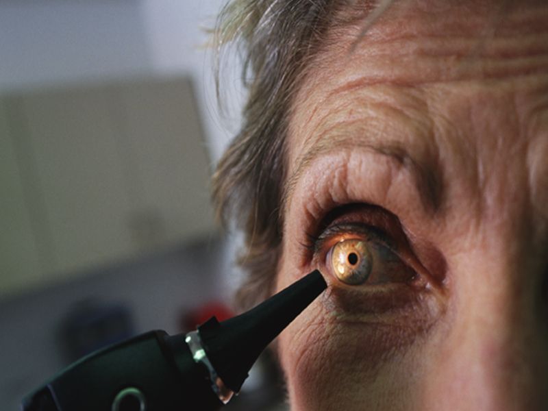 Ocular Safety Profile of Novel Oral Antithrombotics Explored