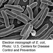 Ground Beef Recalled After <i>E. Coli</i> Outbreak