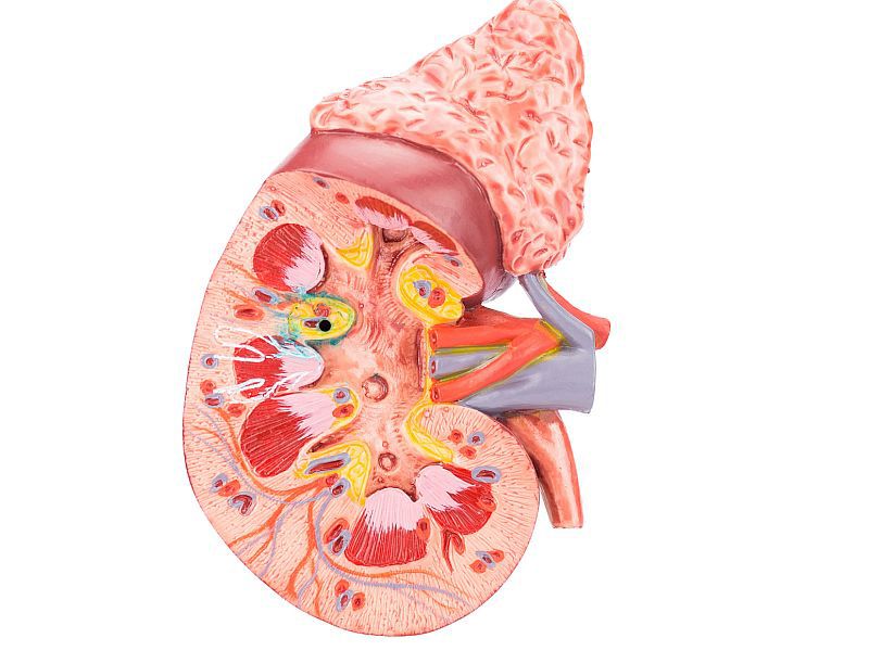 Study Compares Treatment Options for T1a Renal Cancer
