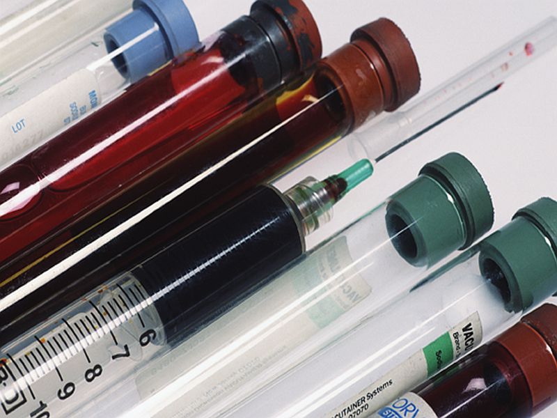 Payment for Laboratory Tests Set to Reduce Starting Jan. 1, 2018