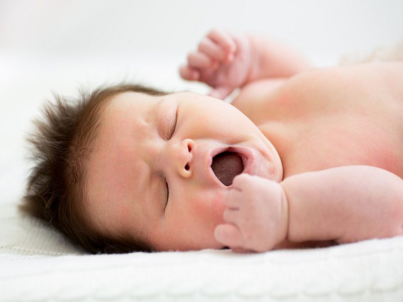Subthreshold Phototherapy After Birth Cuts Later Phototherapy