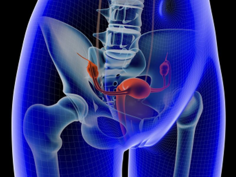 2010 to 2013 Saw Increase in Laparoscopic Hysterectomies