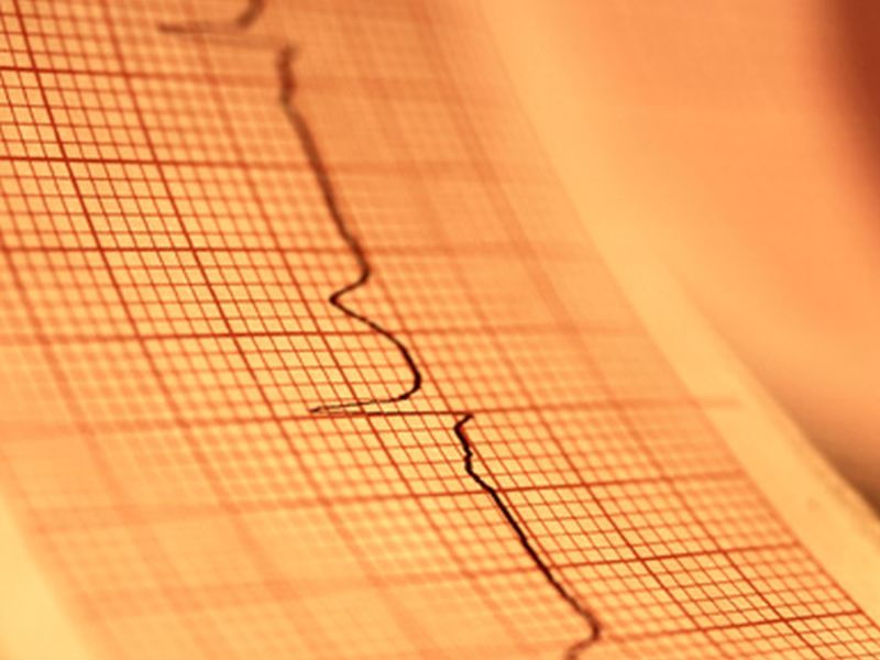 Risk Conferred by T2D Modified by HbA1c in Heart Failure
