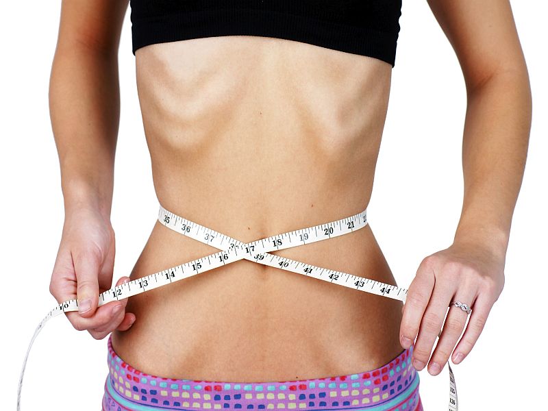 Poor Outcomes Common With Childhood Anorexia Nervosa