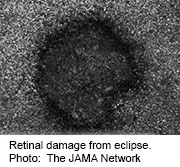 Structural Findings of Acute Solar Retinopathy Described