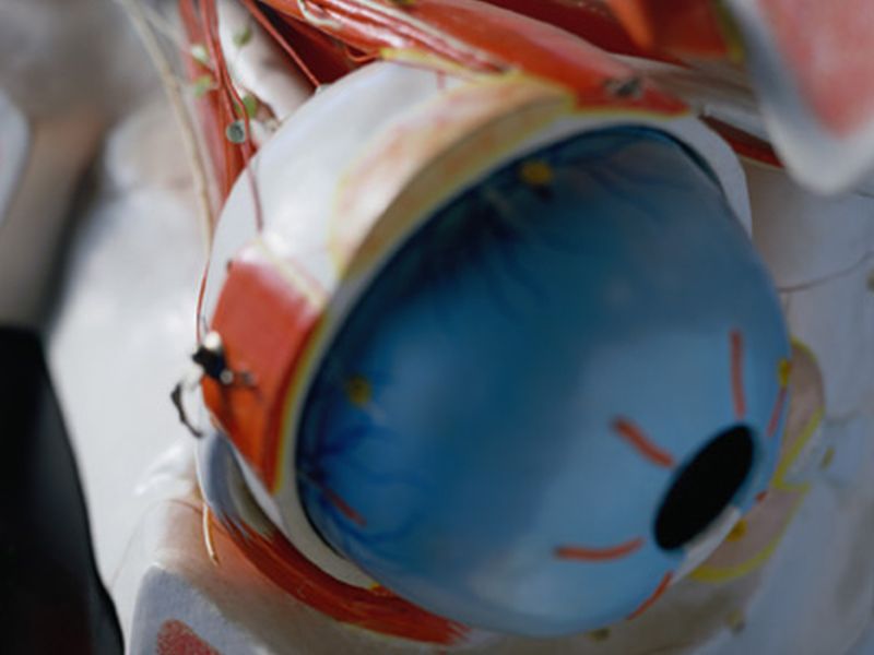 Factors for Poor HRQOL ID'd in Patients Treated for Glaucoma