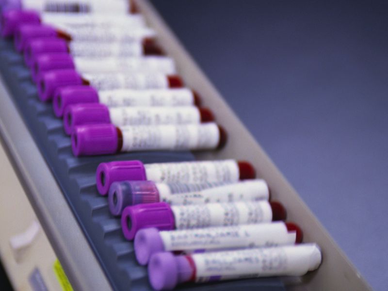 More Laboratory Tests Performed at Major Teaching Hospitals