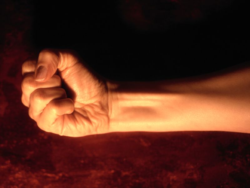 Stem-Cell Transplantation Beneficial for Scleroderma