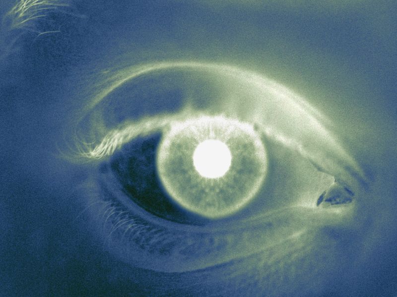 Femtosecond Laser Safer for Post-Vitrectomy Cataract Surgery