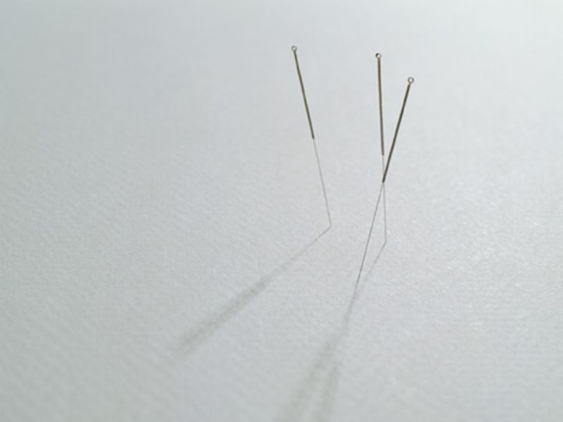 Electrotherapy, Acupuncture Ease Post Knee Arthroplasty Pain