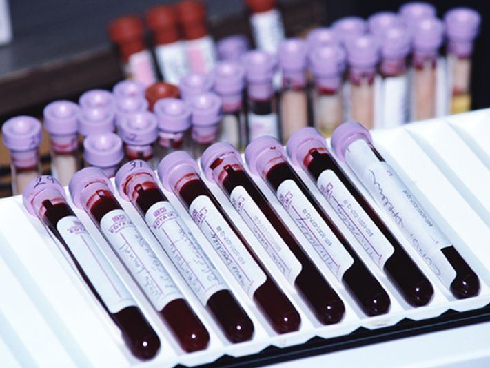 ASCO: Liquid Biopsy Accurate for Detecting Colorectal Cancer