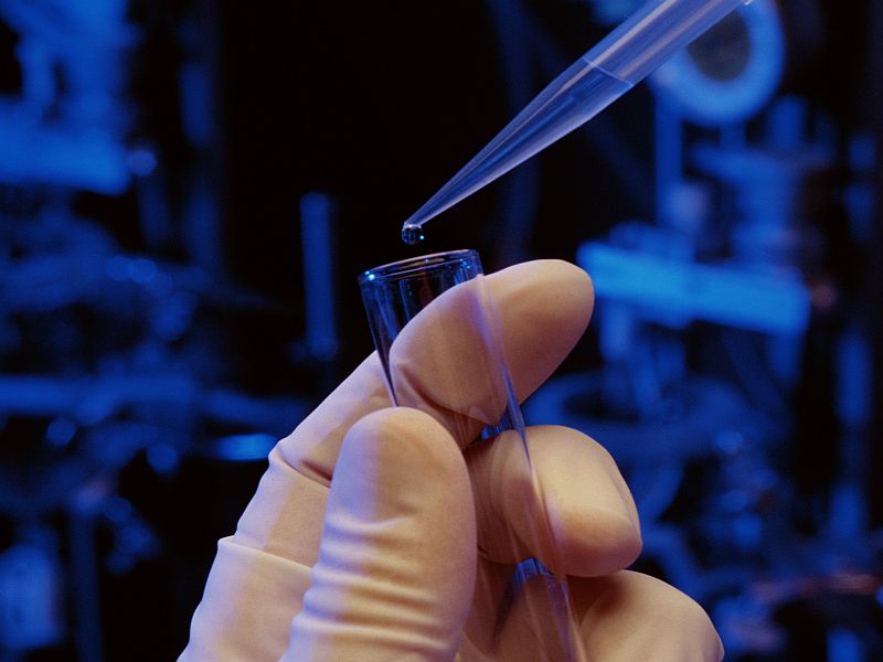 AAN: Alpha-Synuclein Levels in Tears May Help ID Parkinson's