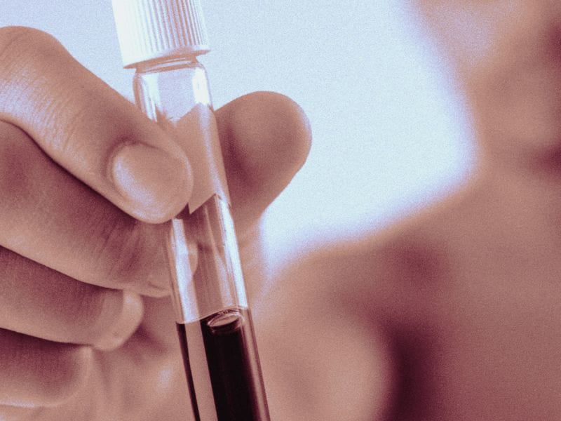 High-Sensitivity Blood Test May Help Rule Out Intracranial Injury