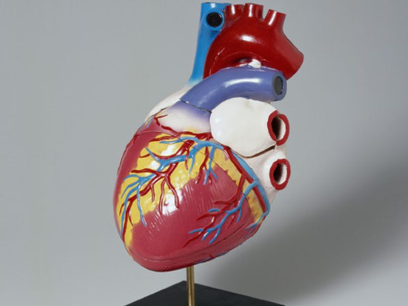 Mental Stress-Induced Myocardial Ischemia Risk Up for Women