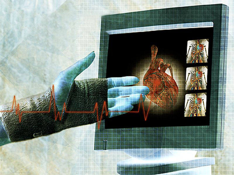 Women With Non-Obstructive CAD May Suffer From Myocardial Scars