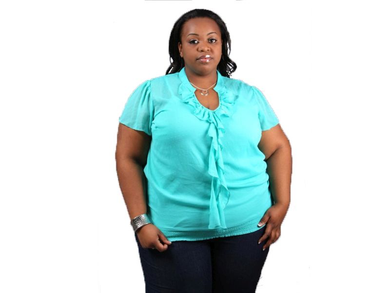 Low Rates of Major Complications After Bariatric Surgery