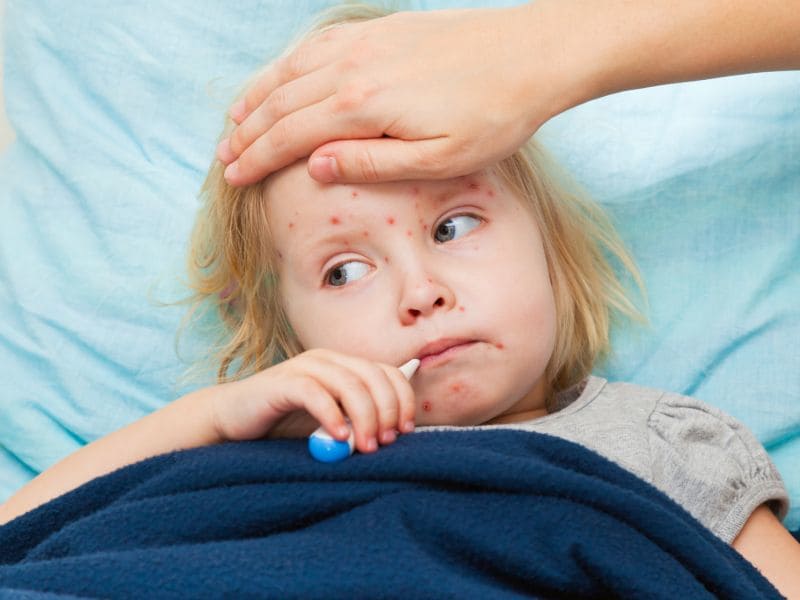 New York City 2013 Measles Outbreak Proved Costly