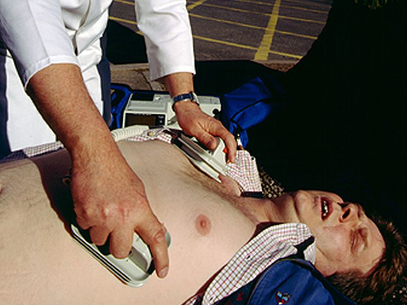 CPR Less Likely for Cardiac Arrests in Black Neighborhoods