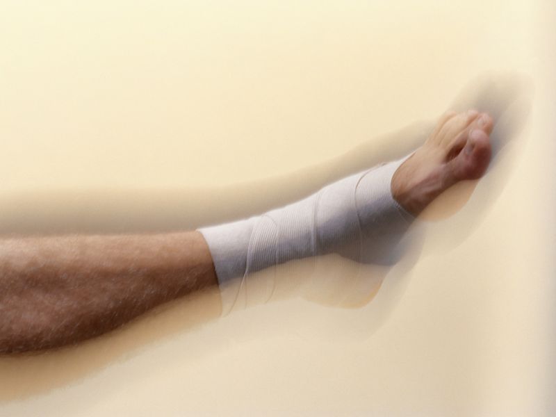 Platelet-Rich Plasma Effective for Chronic Venous Leg Ulcers
