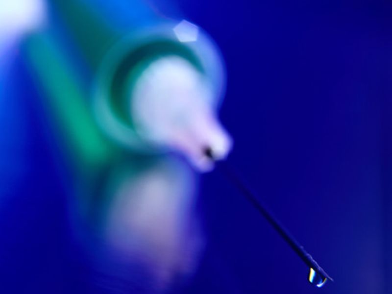 AAOS: Stem Cell Tx for Knee OA Costs About $5,000 Per Injection