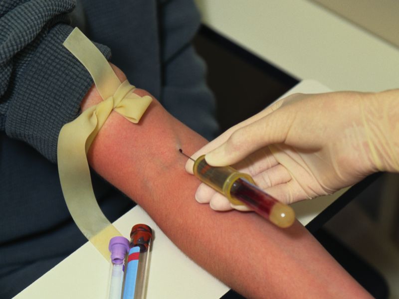 Universal Screening Best Strategy for Hepatitis C in France