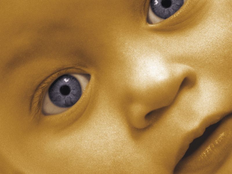 Low Postnatal Levels of Arachidonic Acid Linked to ROP
