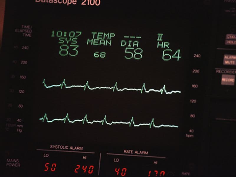 Novel hs-cTnT Protocol Better Rules Out Myocardial Infarction