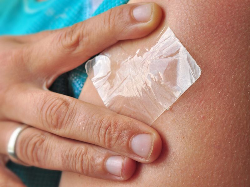 Estrogen Via Patch Superior for Menopausal Sexual Symptoms
